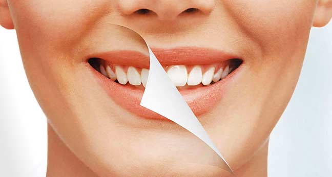 All you Need to Know about Smile Makeover