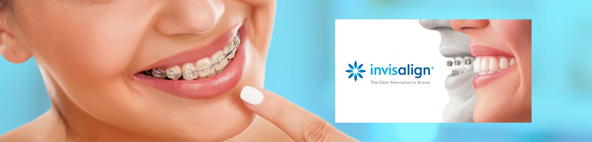 Invisalign & Clear Correct - Leone Dental Group